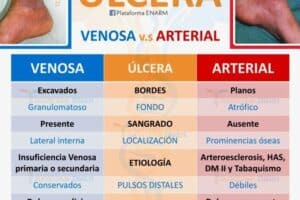 Plantas Medicinales para Ulceras Varicosas